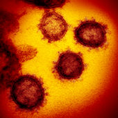 Одно из изображения нового коронавируса, полученное с помощь просвечивающего электронного микроскопа учеными из Лаборатории Скалистых гор (RML) Национального института аллергии и инфекционных заболеваний (NIAID) / © NIAID