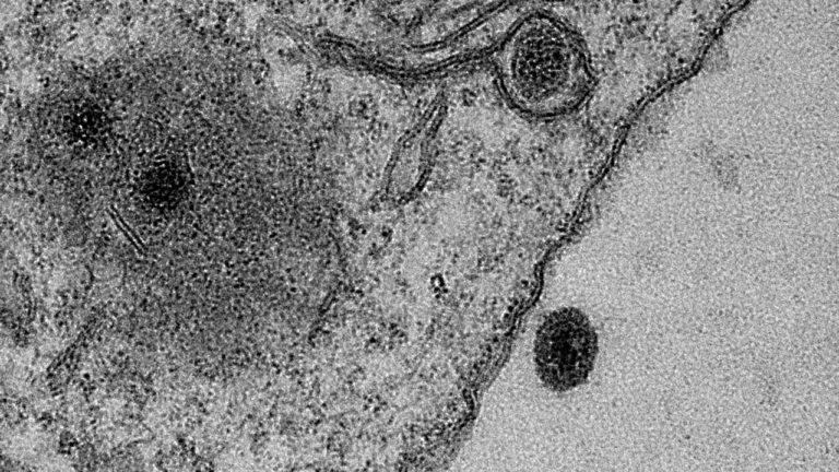 Частицы яравируса и клетка амебы