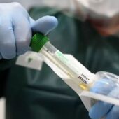 Ранее медики заявляли, что вакцина от коронавируса нового типа появится как минимум через год / © Getty Images