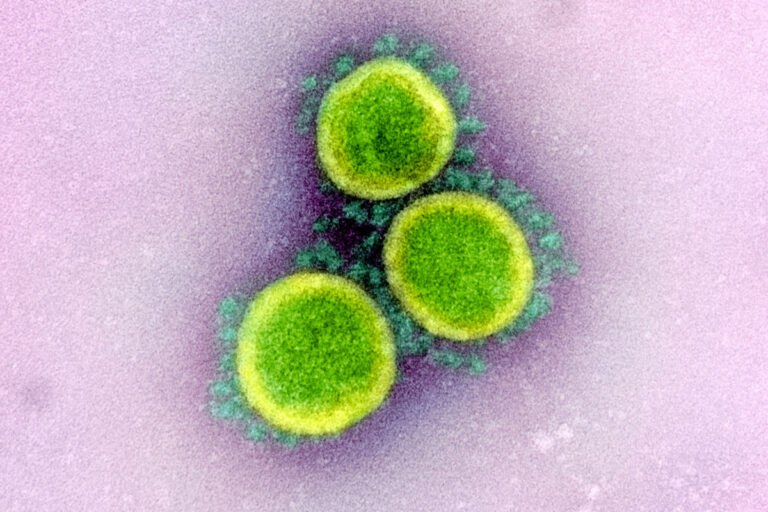 Изображение капсидов вируса SARS-CoV-2, полученные на сканирующем и просвечивающем электронном микроскопе / © NIAID