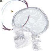 Новый метод поможет визуализировать мозг пациентов, для которых это было прежде затруднительно.