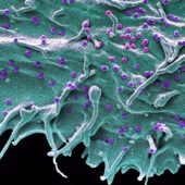 Клетка человека, инфицированная SIVsm — «двоюродным братом» ВИЧ.
