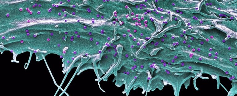 Клетка человека, инфицированная SIVsm — «двоюродным братом» ВИЧ.