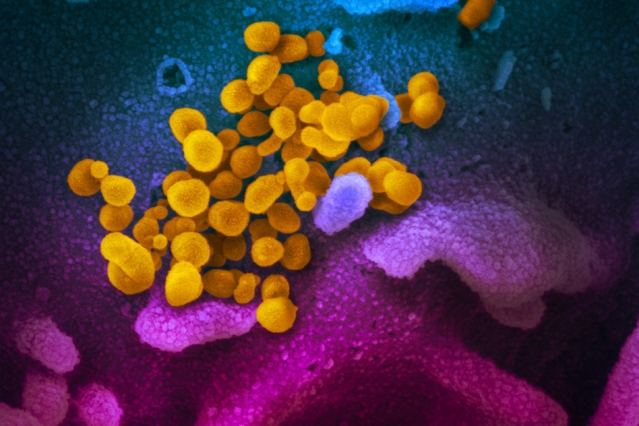 Изображение, полученное с помощью электронного микроскопа, показывает возбудителя COVID-19 — вирус SARS-CoV-2 (желтый)