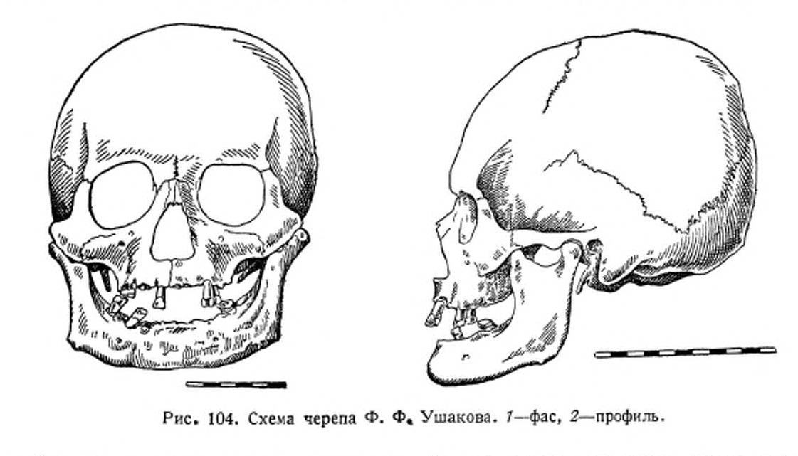 На рисунке изображен череп и реконструкция