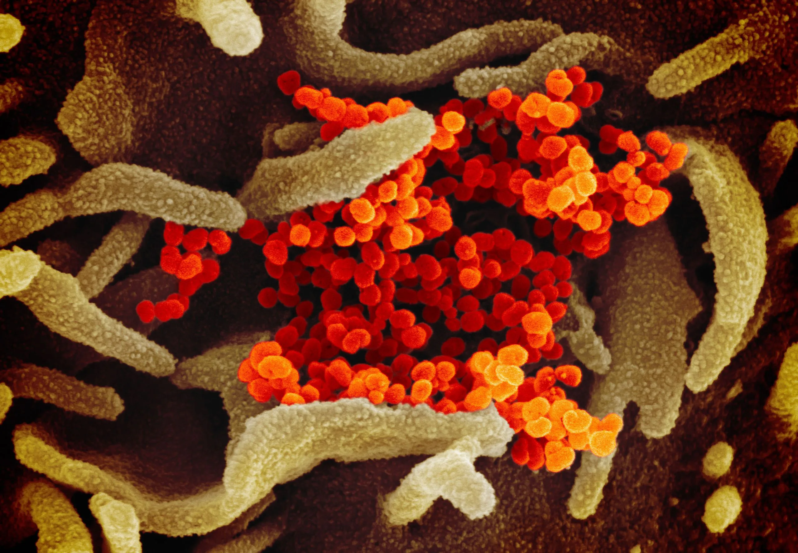 Раскрашенное изображение коронавируса, полученное с помощью электронного микроскопа