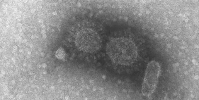 Капсиды SARS-CoV-2 / © Instituto Adolfo Lutz