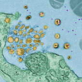 Обработанная микрофотография, показывающая процесс поглощения токсинов (фиолетовые) экзосомами (желтые), выделяемыми клетками легких (зеленые)