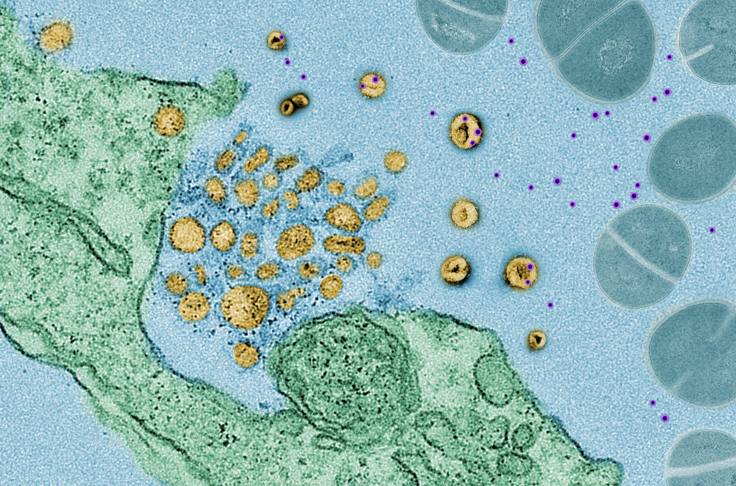 Обработанная микрофотография, показывающая процесс поглощения токсинов (фиолетовые) экзосомами (желтые), выделяемыми клетками легких (зеленые)