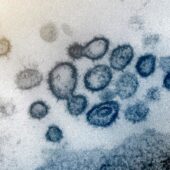 Снимок коронавируса