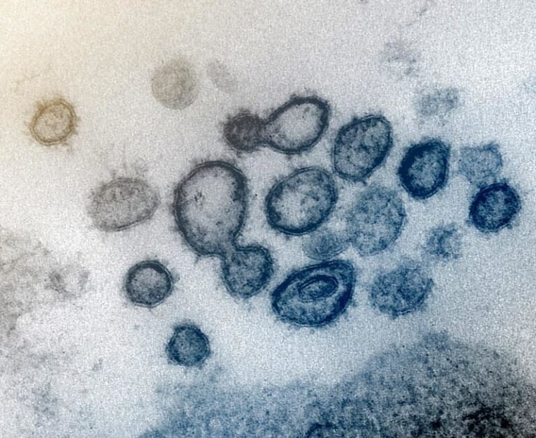 Снимок коронавируса