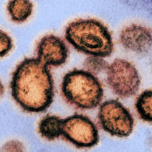 Микрофотография вируса SARS-CoV-2