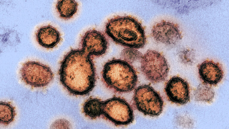 Микрофотография вируса SARS-CoV-2