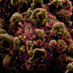 Коронавирус SARS-CoV-2 оказался в три раза агрессивнее возбудителя атипичной пневмонии