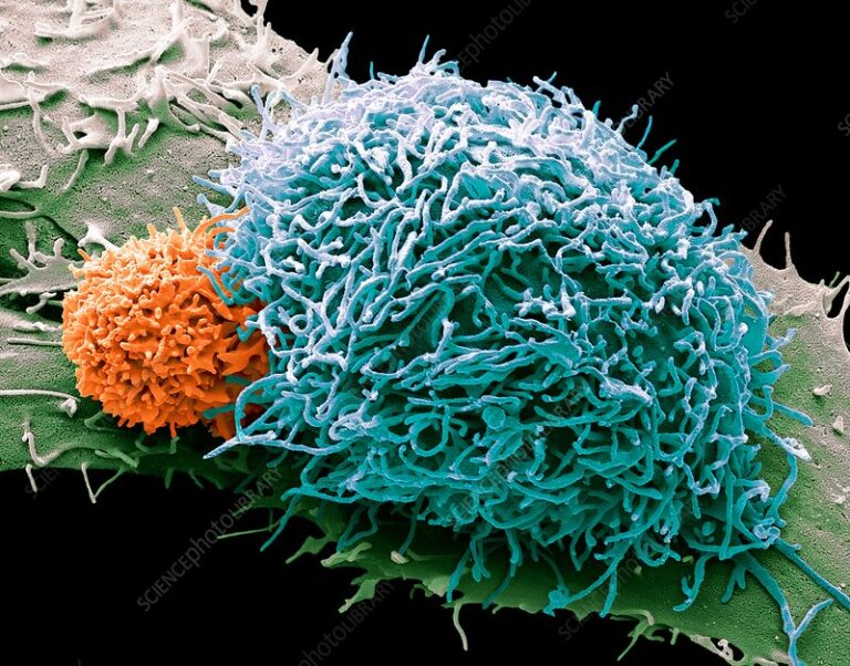 лимфоцит и раковая клетка