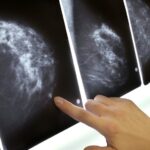 Ученые рассказали о наследуемых признаках, связанных с раком груди
