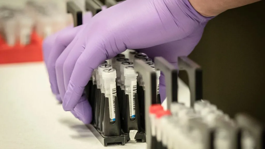 Работа ученых из Фуданьского университета ставит под вопрос действенность пассивной терапии антителами и возможность создания вакцины против SARS-CoV-2 / Sky News