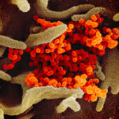 Микрофотография коронавирусных частиц