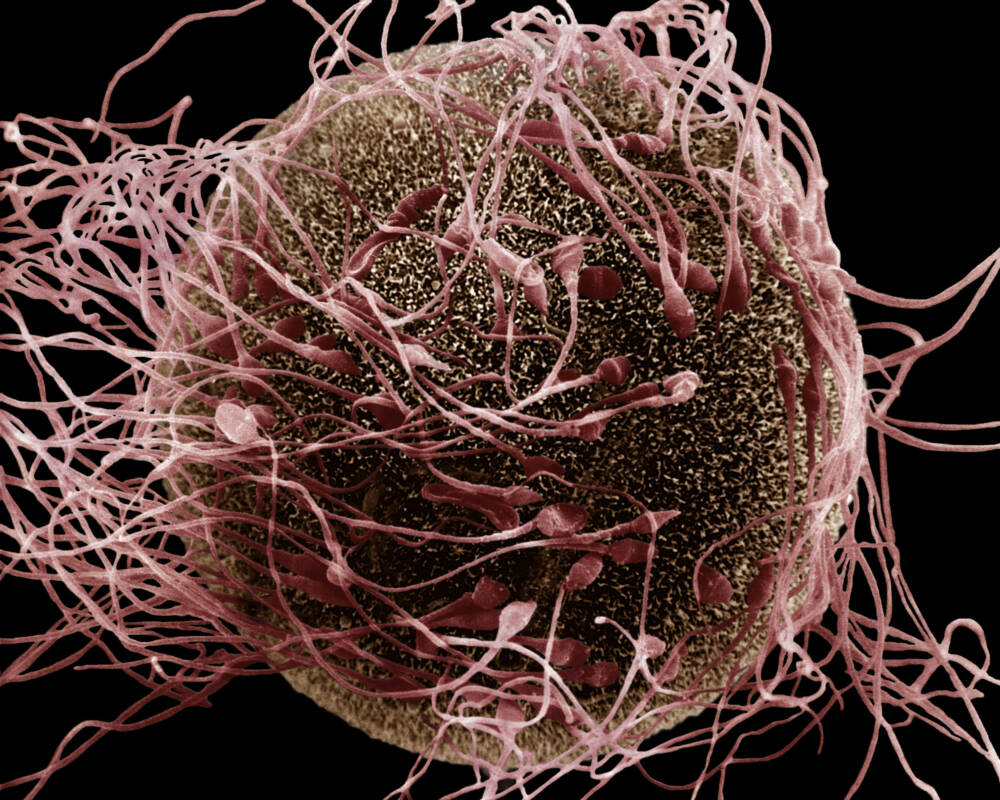 Оплодотворение яйцеклетки под микроскопом