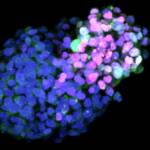 Ученые вырастили из стволовых клеток упрощенный эмбрион человека