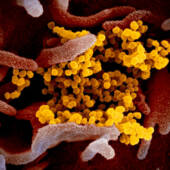 Изображение вируса SARS-CoV-2 (желтый), который вызывает Covid-19 © NIAID
