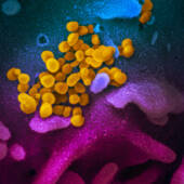 Фото коронавируса SARS-CoV-2 / © NIAID