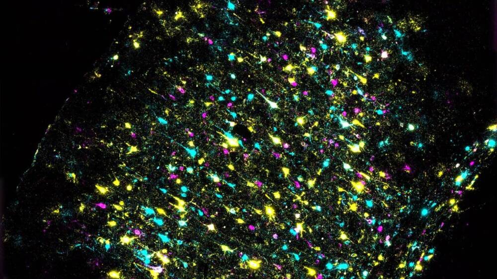 Участок мозга мыши окрашивают для идентификации отдельных нейронов и всех их связей. Подсвеченные области представляют собой отдельный штрих-код ДНК. / © Лаборатория CSHL.