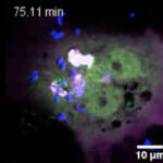 Смерть клетки, зараженной туберкулезом, показали на видео