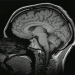 Ученые опровергли предположение о деградации мозга на орбите. Это упростит изучение дальнего космоса