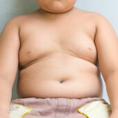 Детское ожирение
