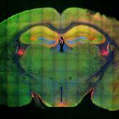 На снимке: гиппокамп — желтая область ближе к вершине; зеленым отмечены нейроны, которые были активированы при формировании памяти; красным — нейроны, которые были активированы при воспоминании; синий отмечена ДНК / © MIT