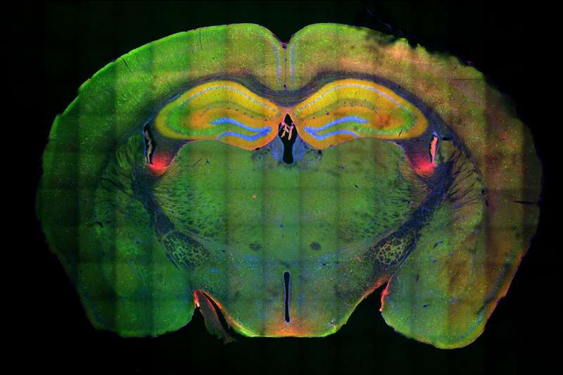 На снимке: гиппокамп — желтая область ближе к вершине; зеленым отмечены нейроны, которые были активированы при формировании памяти; красным — нейроны, которые были активированы при воспоминании; синий отмечена ДНК / © MIT