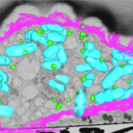 Жировые капли помогли в борьбе с бактериями