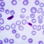 Биологи выяснили механизм устойчивости малярийных плазмодиев к высокой температуре