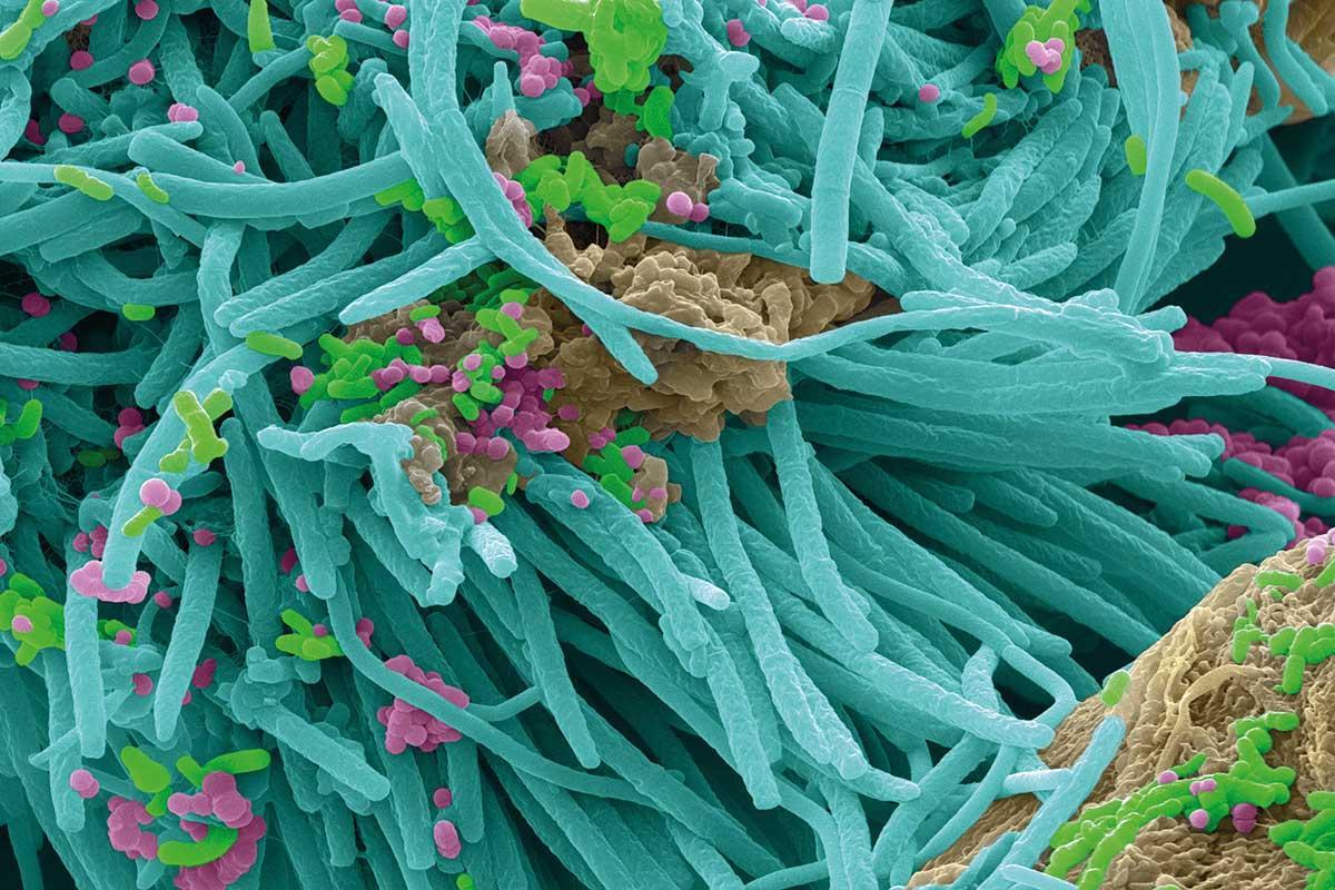 Прокариоты 2 вирусы. Тиомаргарита бактерия. Бактерии под микроскопом. Микроорганизмы под микроскопом. Полезные микробы под микроскопом.