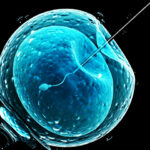 Медики не подтвердили связь между экстракорпоральным оплодотворением и злокачественными опухолями яичников
