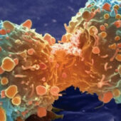 Раковая клетка в процессе деления