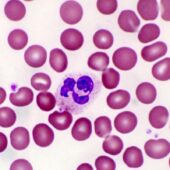 Нейтрофил среди других клеток крови