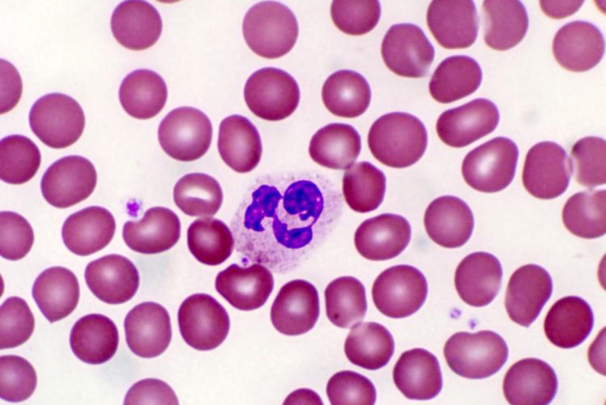 Нейтрофил среди других клеток крови