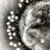 Бактериофаги, прикрепленные к клетке / ©Wkipedia