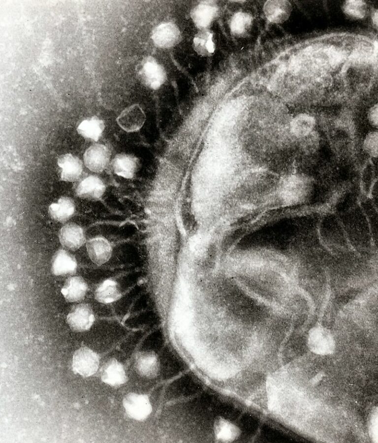 Бактериофаги, прикрепленные к клетке / ©Wkipedia