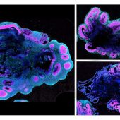 В возрасте пяти недель органоиды человеческого мозга (слева) намного больше, чем у гориллы (вверху справа) и шимпанзе (внизу справа) / ©С.Бенито-Квечински / MRC LMB / Cell