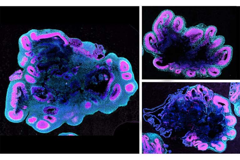 В возрасте пяти недель органоиды человеческого мозга (слева) намного больше, чем у гориллы (вверху справа) и шимпанзе (внизу справа) / ©С.Бенито-Квечински / MRC LMB / Cell