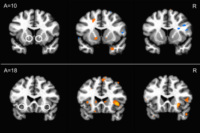 Активность мозга трейдеров предсказала изменения котировок лучше, чем их действия