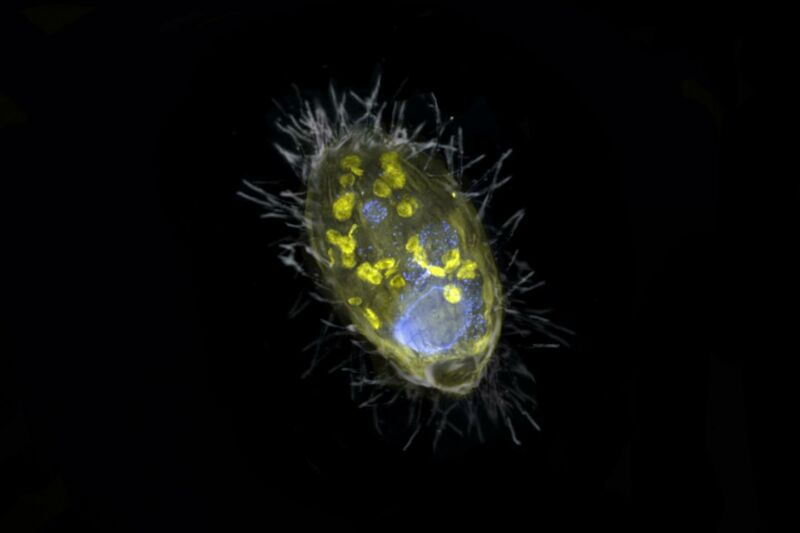Бактериальные клетки внутри плагиопилиды окрашены желтым