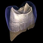 Следы зубочистки указали, что неандертальцы заботились о гигиене полости рта