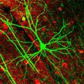 Пирамидный нейрон коры головного мозга мыши, экспрессирующий зелёный флуоресцентный белок (GFP) / ©Wikipedia
