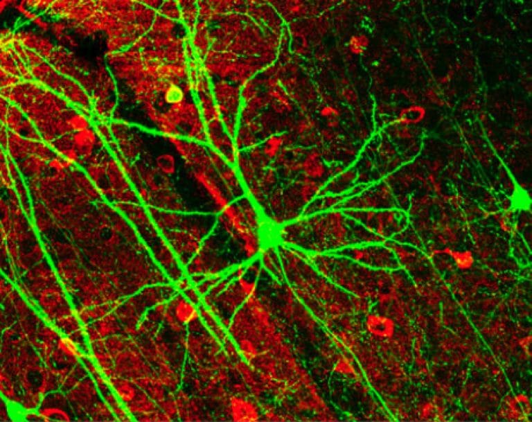 Пирамидный нейрон коры головного мозга мыши, экспрессирующий зелёный флуоресцентный белок (GFP) / ©Wikipedia