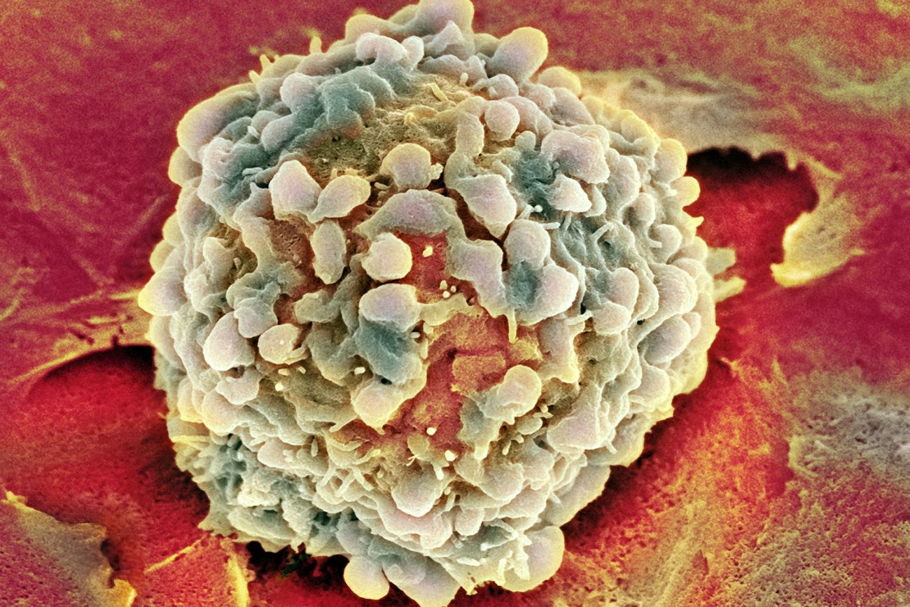 Раковые клетки выключают «контроль качества» при синтезе ДНК
