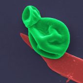 Разрушенные микробные клетки под микроскопом